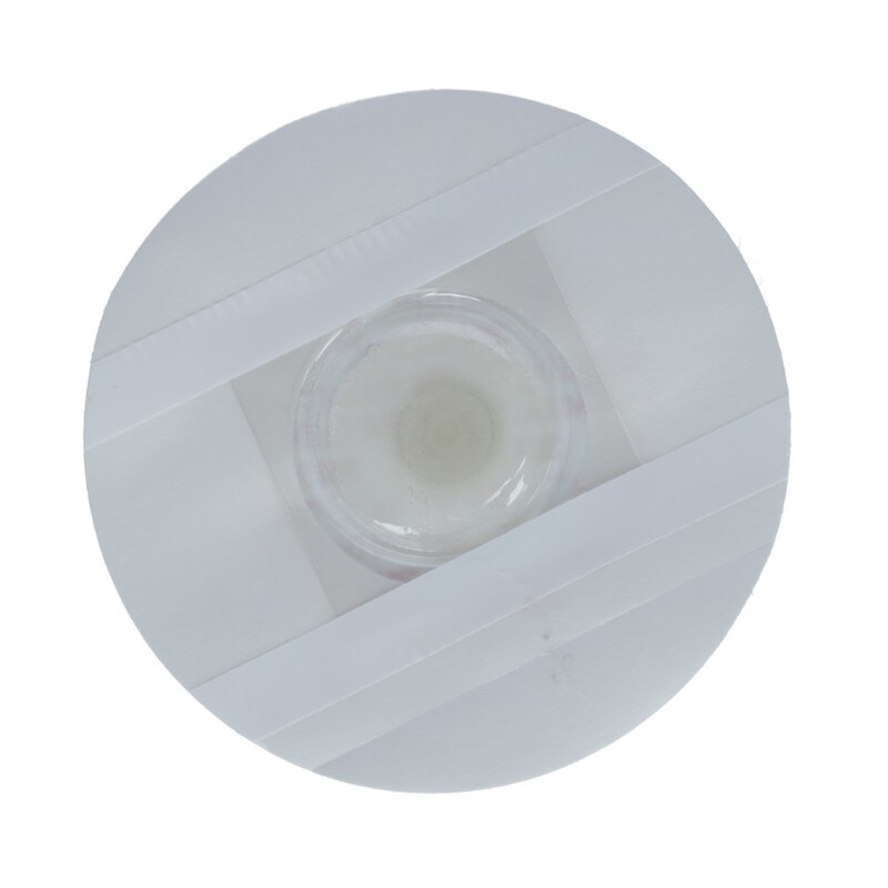 Holter 24h EKG/ECG monitor srdcového rytmu s online analýzou dát