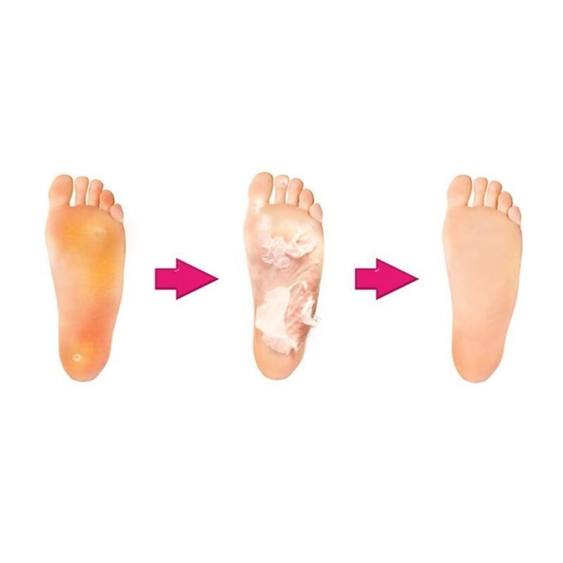 Exfoliačné ponožky na zrohovatenú kožu, 4 ks – VÝPREDAJ, EXSPIRÁCIA 19.5.2025